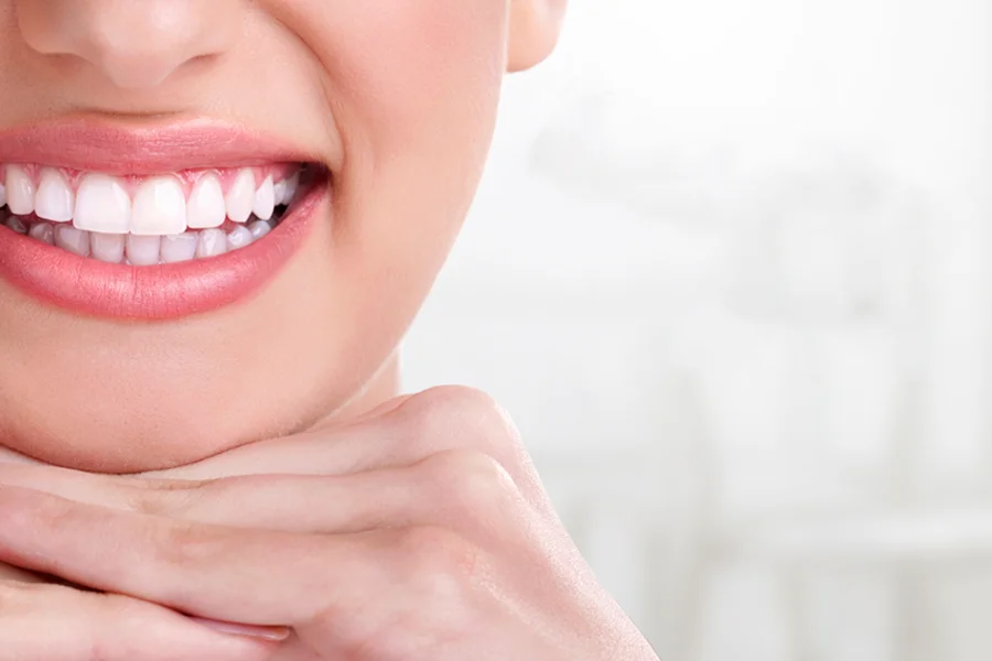 Paciente con sonrisa blanca después de un blanqueamiento dental
